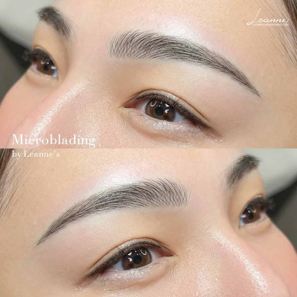 การดูแลหลังฝังสีคิ้ว