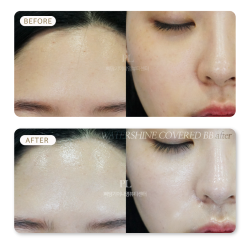 Korean Glow Treatment